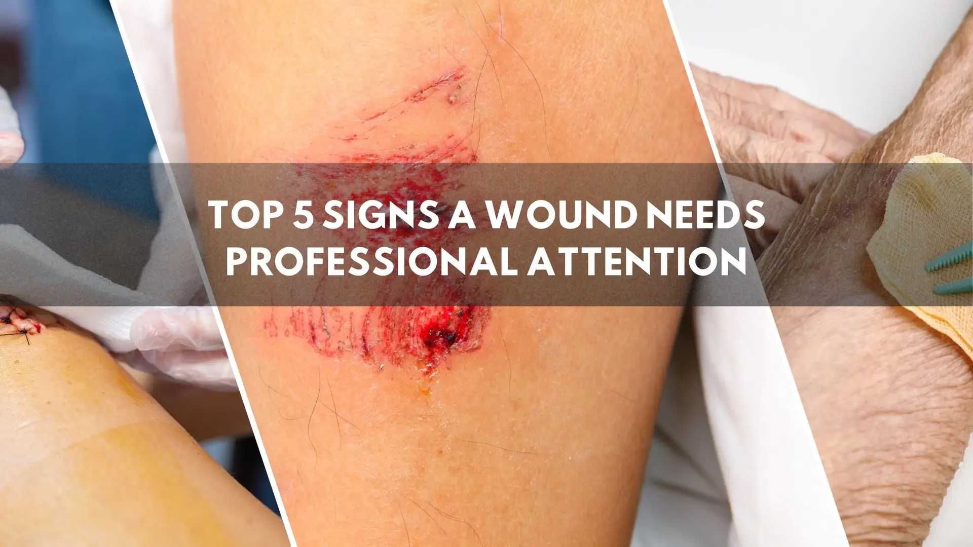 wound needs professional attention